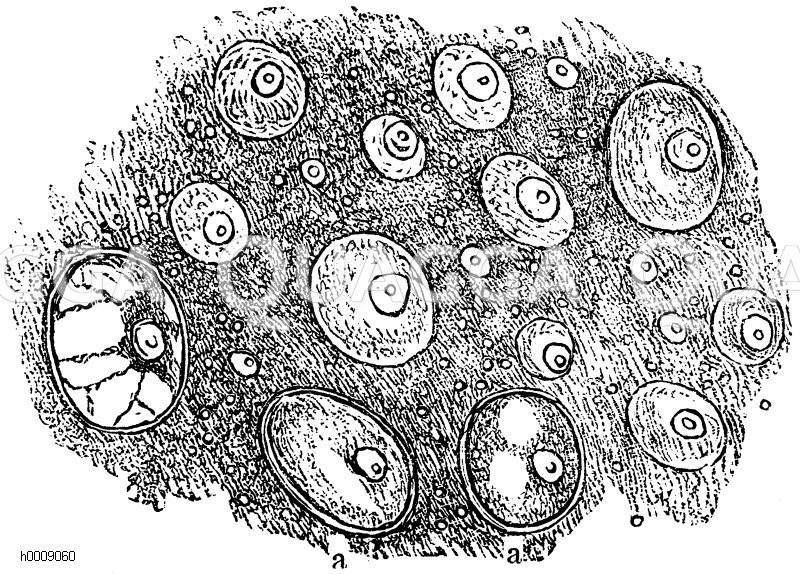 Freie Zellbildung im Embryosack der Schminkbohne. aa) bereits vollendeten Zellen [Digital]