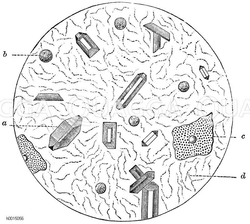 Mikroskopisches Bild des Harnes bei Blasenkatarr. a) Phosphorsäure Ammon-Magnesia, b) Schleimzelle, c) Blasenepithel, d) Bakterien [Digital]