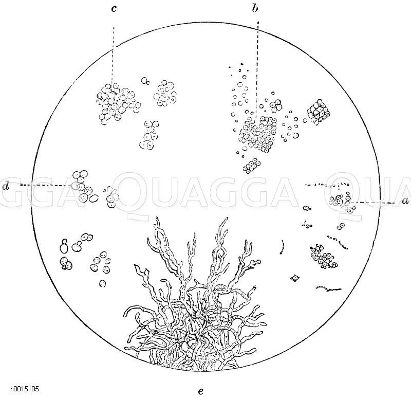 a) Mikrokokken, b) Sarzine, c) Pilze der sauren Harngärung, d) Hefezellen, e) Schimmelpilze [Digital]