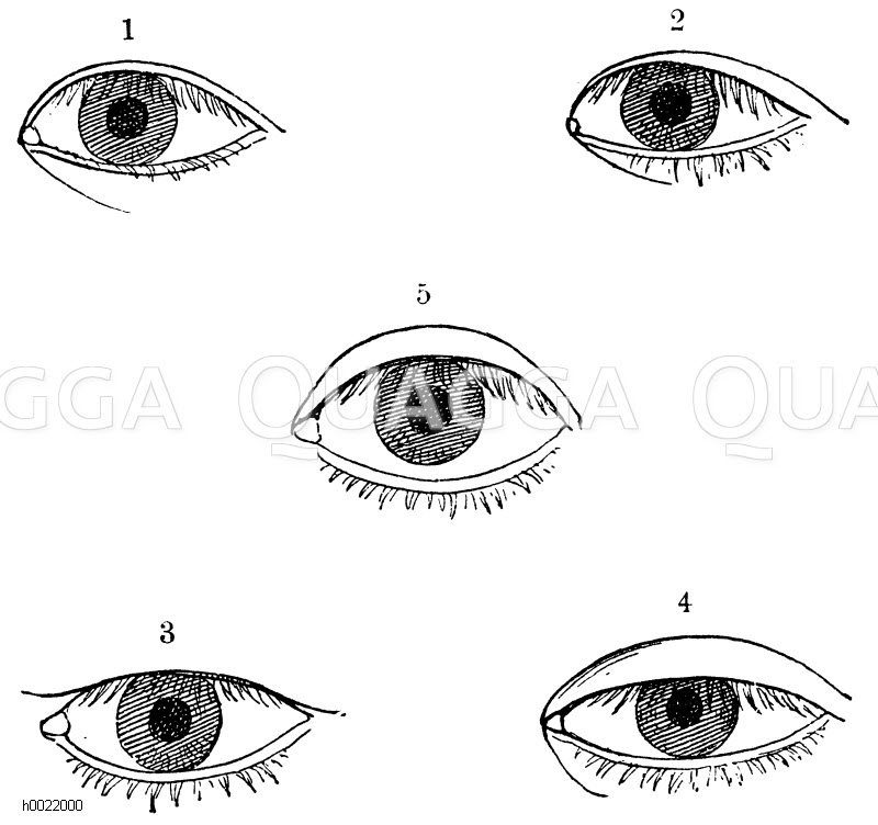 Auge. Mongoloide Augenformen (nach Metschnikow) [Digital]