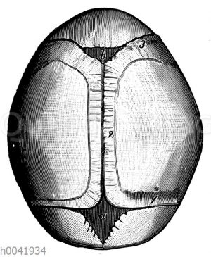 Fontanellen am Schädeldach eines neugeborenen Kindes